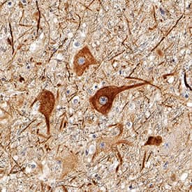 NF-L was detected in immersion fixed paraffin-embedded sections of human brain (substantia nigra) using Mouse Anti-Human NF-L Monoclonal Antibody (Catalog # MAB2216) at 3 µg/mL for 1 hour at room temperature followed by incubation with the Anti-Mouse IgG VisUCyte™ HRP Polymer Antibody (VC001). Tissue was stained using DAB (brown) and counterstained with hematoxylin (blue). Specific staining was localized to cytoplasm in neurons. View our protocol for IHC Staining with VisUCyte HRP Polymer Detection Reagents.