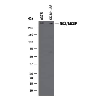 Western blot shows lysates of A375 human melanoma cell line and SK-Mel-28 human malignant melanoma cell line. PVDF membrane was probed with 0.5 µg/mL of Goat Anti-Human NG2/MCSP Antigen Affinity-purified Polyclonal Antibody (Catalog # AF2585) followed by HRP-conjugated Anti-Goat IgG Secondary Antibody (Catalog # HAF017). A specific band was detected for NG2/MCSP at approximately 300 kDa (as indicated). This experiment was conducted under reducing conditions and using Immunoblot Buffer Group 1.