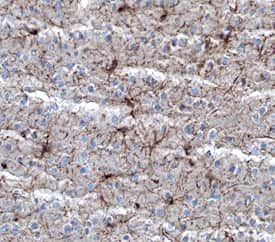 NG2/MCSP was detected in perfusion fixed frozen sections of mouse brain (cortex) using Rat Anti-Mouse NG2/MCSP Monoclonal Antibody (Catalog # MAB6689) at 25 µg/mL overnight at 4 °C. Tissue was stained using the Anti-Rat HRP-DAB Cell & Tissue Staining Kit (brown; Catalog # CTS017) and counterstained with hemotoxylin (blue). Specific staining was localized to glial cells. View our protocol for Chromogenic IHC Staining of Frozen Tissue Sections.