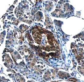 NIK/MAP3K14 was detected in immersion fixed paraffin-embedded sections of human pancreas using Mouse Anti-Human NIK/MAP3K14 Monoclonal Antibody (Catalog # MAB6888) at 15 µg/mL overnight at 4 °C. Before incubation with the primary antibody, tissue was subjected to heat-induced epitope retrieval using Antigen Retrieval Reagent-Basic (Catalog # CTS013). Tissue was stained using the Anti-Mouse HRP-DAB Cell & Tissue Staining Kit (brown; Catalog # CTS002) and counterstained with hematoxylin (blue). Specific staining was localized to pancreatic islets. View our protocol for Chromogenic IHC Staining of Paraffin-embedded Tissue Sections.