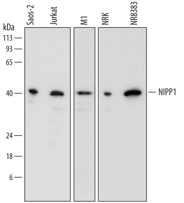 Western blot shows lysates of Saos-2 human osteosarcoma cell line, Jurkat human acute T cell leukemia cell line, M1 mouse myeloid leukemia cell line, NRK rat normal kidney cell line, and NR8383 rat alveolar macrophage cell line. PVDF membrane was probed with 0.5 µg/mL of Sheep Anti-Human/Mouse/Rat NIPP1 Antigen Affinity-purified Polyclonal Antibody (Catalog # AF7240) followed by HRP-conjugated Anti-Sheep IgG Secondary Antibody (Catalog # HAF016). A specific band was detected for NIPP1 at approximately 40 kDa (as indicated). This experiment was conducted under reducing conditions and using Immunoblot Buffer Group 1.