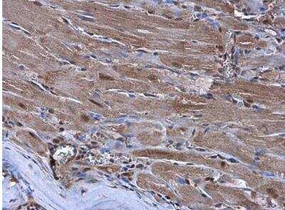 Immunohistochemistry-Paraffin: NKX2.5 Antibody [NBP1-31558] -  Rat heart. Nkx2.5 stained by Nkx2.5 antibody diluted at 1:500. Antigen Retrieval: Citrate buffer, pH 6.0, 15 min.