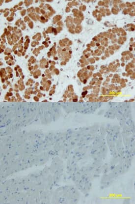 NKX2.5 was detected in immersion fixed paraffin-embedded sections of human heart using Goat Anti-Human NKX2.5 Biotinylated Antigen Affinity-purified Polyclonal Antibody (Catalog # BAF2444) at 15 µg/mL overnight at 4 °C. Tissue was stained using the Anti-Goat HRP-DAB Cell & Tissue Staining Kit (brown; Catalog # CTS008) and counterstained with hematoxylin (blue). Lower panel shows a lack of labeling if primary antibodies are omitted and tissue is stained only with secondary antibody followed by incubation with detection reagents. View our protocol for Chromogenic IHC Staining of Paraffin-embedded Tissue Sections.