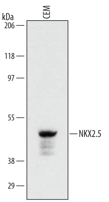 Western blot shows lysates of CEM human T-lymphoblastoid cell line. PVDF membrane was probed with 1 µg/mL of Human NKX2.5 Monoclonal Antibody (Catalog # MAB24441) followed by HRP-conjugated Anti-Mouse IgG Secondary Antibody (Catalog # HAF007). A specific band was detected for NKX2.5 at approximately 48 kDa (as indicated). This experiment was conducted under reducing conditions and using Immunoblot Buffer Group 1.