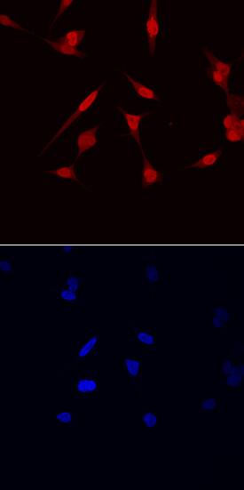 NKX3.1 was detected in immersion fixed LNCaP human prostate cancer cell line using Goat Anti-Human NKX3.1 Antigen Affinity-purified Polyclonal Antibody (Catalog # AF6080) at 10 µg/mL for 3 hours at room temperature. Cells were stained using the NorthernLights™ 557-conjugated Anti-Goat IgG Secondary Antibody (red; Catalog # NL001) and counterstained with DAPI (blue). Specific staining was localized to nuclei. View our protocol for Fluorescent ICC Staining of Cells on Coverslips.