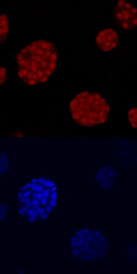 NKX6.1 was detected in immersion fixed  beta TC-6 mouse beta cell insulinoma cell line using Human NKX6.1 Monoclonal Antibody (Catalog # MAB5857) at 10 µg/mL for 3 hours at room temperature. Cells were stained using the NorthernLights™ 557-conjugated Anti-Mouse IgG Secondary Antibody (red, upper panel; Catalog # NL007) and counterstained with DAPI (blue, lower panel). Specific staining was localized to nuclei. View our protocol for Fluorescent ICC Staining of Cells on Coverslips.