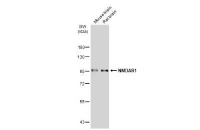 Nmdar1 clearance