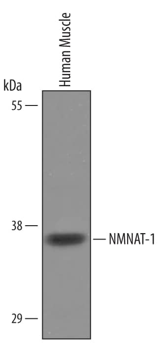 Western blot shows lysates of human muscle tissue. PVDF Membrane was probed with 1 µg/mL of Sheep Anti-Human NMNAT-1 Antigen Affinity-purified Polyclonal Antibody (Catalog # AF5865) followed by HRP-conjugated Anti-Sheep IgG Secondary Antibody (Catalog # HAF016). A specific band was detected for NMNAT-1 at approximately 35 kDa (as indicated). This experiment was conducted under reducing conditions and using Immunoblot Buffer Group 8.