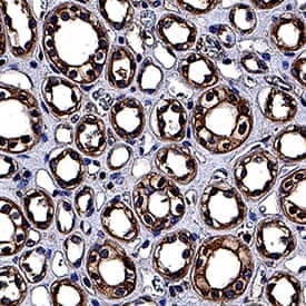 Immunohistochemistry NPRA/NPR1 Antibody (377018) [Unconjugated]