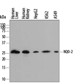 Western blot shows lysates of human liver tissue, human kidney tissue, HepG2 human hepatocellular carcinoma cell line, K562 human chronic myelogenous leukemia cell line, and A549 human lung carcinoma cell line. PVDF membrane was probed with 0.25 µg/mL of Sheep Anti-Human NQO-2 Antigen Affinity-purified Polyclonal Antibody (Catalog # AF7868) followed by HRP-conjugated Anti-Sheep IgG Secondary Antibody (Catalog # HAF016). A specific band was detected for NQO-2 at approximately 26 kDa (as indicated). This experiment was conducted under reducing conditions and using Immunoblot Buffer Group 1.