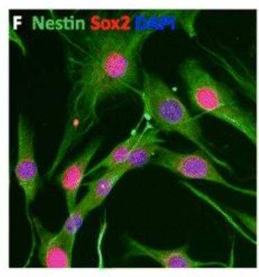 Immunocytochemistry/Immunofluorescence: Nestin Antibody [NB100-1604] - Characterization of MSCmix and NCSCmix isolated from the bone marrow of adult Wnt1-CRE/R26R-LacZ mice. NCSCmix  express Nestin (green), Sox2 (red) Scale bar = 20 um. NCSC = neural crest stem cell, MSC = mesenchymal stem cell. Image collected and cropped by CiteAb from the following publication (//stemcellres.com/content/6/1/211) licensed under a CC-BY licence.