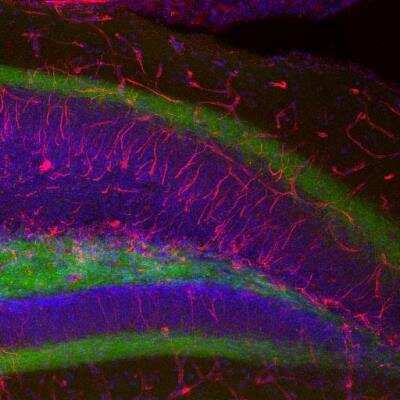Immunohistochemistry-Paraffin: Nestin Antibody [NB100-1604] - Photomicrograph of a paraffin-embedded tissue section through an adult dentate gyrus of the hippocampal formation from a paraformaldehyde-fixed (4%) mouse brain. RED shows nestin immunoreactivity as visualized with a Texas Red goat anti-chicken IgY antibody. Green is staining of the granule cells; BLUE is DAPI nuclear staining.