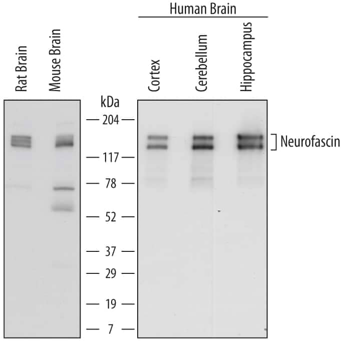 Western blot shows lysates of rat brain tissue, mouse brain tissue, human brain (cortex) tissue, human brain (cerebellum) tissue, and human brain (hippocampus) tissue. PVDF membrane was probed with 0.5 µg/mL of Mouse Anti-Human/Mouse/Rat Neurofascin Monoclonal Antibody (Catalog # MAB3235) followed by HRP-conjugated Anti-Mouse IgG Secondary Antibody (Catalog # HAF007). Specific bands were detected for Neurofascin at approximately 140 to 155 kDa (as indicated). This experiment was conducted under reducing conditions and using Immunoblot Buffer Group 1.