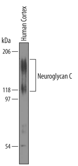 Western blot shows lysates of SH-SY5Y human neuroblastoma cell line. PVDF membrane was probed with 1 µg/mL of Sheep Anti-Human Neuroglycan C/CSPG5 Antigen Affinity-purified Polyclonal Antibody (Catalog # AF5685) followed by HRP-conjugated Anti-Sheep IgG Secondary Antibody (Catalog # HAF016). Specific bands were detected for Neuroglycan C/CSPG5 at approximately 120 and 150 kDa (as indicated). This experiment was conducted under reducing conditions and using Immunoblot Buffer Group 8.
