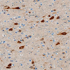 Neurogranin was detected in formalin fixed paraffin-embedded sections of human cortex using Mouse Anti-Human/Mouse/Rat Neurogranin Monoclonal Antibody (Catalog # MAB7947) at 15 µg/mL overnight at 4 °C. Tissue was stained using the Anti-Mouse HRP-DAB Cell & Tissue Staining Kit (brown; Catalog # CTS002) and counterstained with hematoxylin (blue). Specific staining was localized to neuronal cell bodies and dendrites. View our protocol for Chromogenic IHC Staining of Paraffin-embedded Tissue Sections.