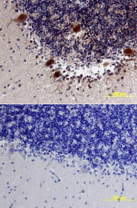 Neuroligin 3/NLGN3 was detected in immersion fixed paraffin-embedded sections of human brain (cerebellum) using Human Neuroligin 3/NLGN3 Monoclonal Antibody (Catalog # MAB6088) at 15 µg/mL overnight at 4 °C. Tissue was stained using the Anti-Mouse HRP-DAB Cell & Tissue Staining Kit (brown; Catalog # CTS002) and counterstained with hematoxylin (blue). Lower panel shows a lack of labeling if primary antibodies are omitted and tissue is stained only with secondary antibody followed by incubation with detection reagents. View our protocol for Chromogenic IHC Staining of Paraffin-embedded Tissue Sections.