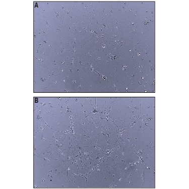 Bioactivity Neuroligin 4Y/NLGN4Y [Unconjugated]