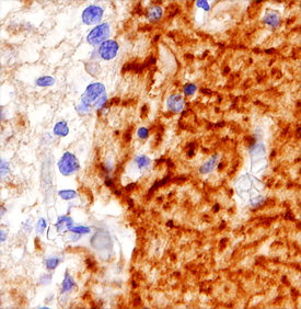 Neuroplastin was detected in immersion fixed paraffin-embedded sections of human brain (cerebellum) using 1.7 µg/mL Sheep Anti-Human Neuroplastin Isoform 1 Antigen Affinity-purified Polyclonal Antibody (Catalog # AF5174) overnight at 4 °C. Tissue was stained with the Anti-Sheep HRP-DAB Cell & Tissue Staining Kit (brown; Catalog # CTS019) and counterstained with hematoxylin (blue). Specific labeling was localized to the dendrites of Purkinje cells. View our protocol for Chromogenic IHC Staining of Paraffin-embedded Tissue Sections.