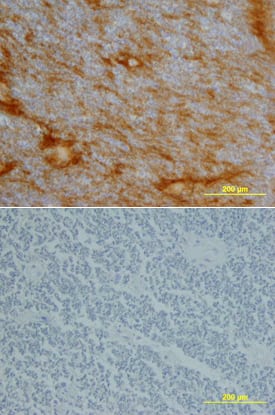 Neurotrimin was detected in immersion fixed paraffin-embedded sections of human spinal cord using Goat Anti-Human Neurotrimin Biotinylated Antigen Affinity-purified Polyclonal Antibody (Catalog # BAF1235) at 15 µg/mL overnight at 4 °C. Tissue was stained using the Anti-Goat HRP-DAB Cell & Tissue Staining Kit (brown; Catalog # CTS008) and counterstained with hematoxylin (blue). Lower panel shows a lack of labeling if primary antibodies are omitted and tissue is stained only with secondary antibody followed by incubation with detection reagents. View our protocol for Chromogenic IHC Staining of Paraffin-embedded Tissue Sections.