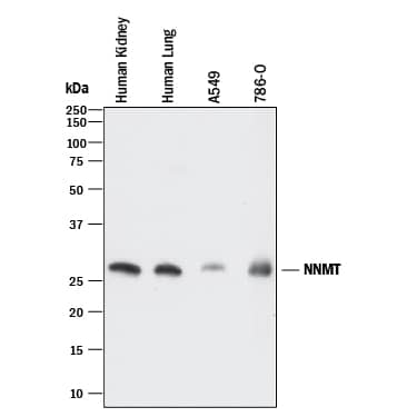 Western blot shows lysates of human kidney tissue, human lung tissue, A549 human lung carcinoma cell line, and 786-O human renal cell adenocarcinoma cell line. PVDF membrane was probed with 2 µg/mL of Mouse Anti-Human Nicotinamide N-Methyltransferase/NNMT Monoclonal Antibody (Catalog # MAB7736) followed by HRP-conjugated Anti-Mouse IgG Secondary Antibody (Catalog # HAF018). A specific band was detected for Nicotinamide N-Methyltransferase/NNMT at approximately 26 kDa (as indicated). This experiment was conducted under reducing conditions and using Immunoblot Buffer Group 1.