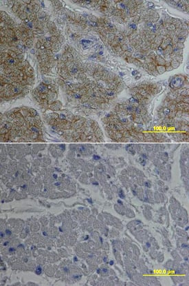 Nidogen-1/Entactin was detected in immersion fixed paraffin-embedded sections of human heart using Goat Anti-Human Nidogen-1/Entactin Biotinylated Antigen Affinity-purified Polyclonal Antibody (Catalog # BAF2570) at 15 µg/mL overnight at 4 °C. Tissue was stained using the Anti-Goat HRP-DAB Cell & Tissue Staining Kit (brown; Catalog # CTS008) and counterstained with hematoxylin (blue). Lower panel shows a lack of labeling if primary antibodies are omitted and tissue is stained only with secondary antibody followed by incubation with detection reagents. View our protocol for Chromogenic IHC Staining of Paraffin-embedded Tissue Sections.