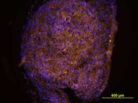 Nidogen-1/Entactin was detected in immersion fixed human mesenchymal stem cells differentiated into chondrocytes using Mouse Anti-Human Nidogen-1/Entactin Monoclonal Antibody (Catalog # MAB2570) at 10 µg/mL for 3 hours at room temperature. Cells were stained using the NorthernLights™ 557-conjugated Anti-Mouse IgG Secondary Antibody (yellow; NL007) and counterstained with DAPI (blue). View our protocol for Fluorescent ICC Staining of Cells on Coverslips.