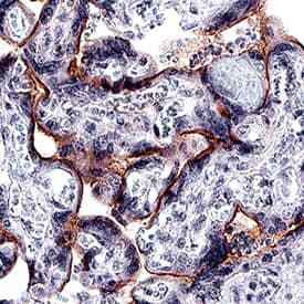    Nope/IGDCC4  was detected in immersion fixed paraffin-embedded sections of human placenta  tissue using Rabbit Anti-Human Nope/IGDCC4 Monoclonal Antibody (Catalog # MAB10345)  at 3 µg/mL for 1 hour at room temperature followed by  incubation with the Anti-Rabbit IgG VisUCyte™ HRP Polymer Antibody  (Catalog # VC003).  Before incubation with the primary antibody, tissue was subjected to  heat-induced epitope retrieval using Antigen Retrieval Reagent-Basic (Catalog  # CTS013).  Tissue was stained using DAB (brown) and counterstained with hematoxylin  (blue). Specific staining was localized to syncytiotrophoblast. View our  protocol for IHC  Staining with VisUCyte HRP Polymer Detection Reagents. 