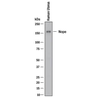 Western blot shows lysates of human uterus tissue. PVDF membrane was probed with 1 µg/mL of Rabbit Anti-Human Nope/IGDCC4 Monoclonal Antibody (Catalog # MAB10345) followed by HRP-conjugated Anti-Rabbit IgG Secondary Antibody (Catalog # HAF008). A specific band was detected for Nope at approximately 150 kDa (as indicated). This experiment was conducted under reducing conditions and using Immunoblot Buffer Group 1.