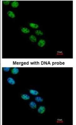 Nova1 Antibodies: Novus Biologicals