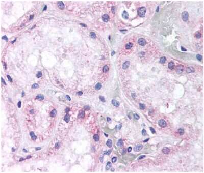 Immunohistochemistry: Nox4 Antibody [NB110-58851] - Analysis using the Biotin conjugate of NB110-58851. Staining of NOX4 in proximal convoluted tubules of human kidney.