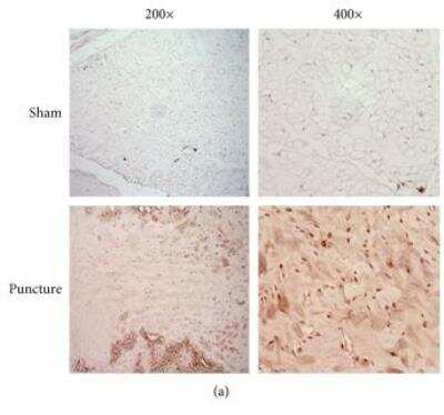 Immunohistochemistry: Nox4 Antibody [NB110-58851] - The expression of Nox4, p21, and Rb was upregulated in degenerative discs. Immunohistochemical staining for Nox4 in NP specimens. Image collected and cropped by CiteAb from the following publication (//www.hindawi.com/journals/omcl/2017/7426458/) licensed under a CC-BY licence.