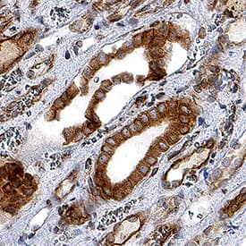         Nox4  was detected in immersion fixed paraffin-embedded sections of human kidney  using Mouse Anti-Human Nox4 Monoclonal Antibody (Catalog # MAB8158) at  1.7 µg/mL for 1 hour at room temperature followed by  incubation with the Anti-Mouse IgG VisUCyte™ HRP Polymer Antibody  (Catalog # VC001).  Before incubation with the primary antibody, tissue was subjected to heat-induced  epitope retrieval using Antigen Retrieval Reagent-Basic (Catalog # CTS013).  Tissue was stained using DAB (brown) and counterstained with hematoxylin  (blue). Specific staining was localized to cytoplasm and nuclei. View our  protocol for IHC  Staining with VisUCyte HRP Polymer Detection Reagents.  