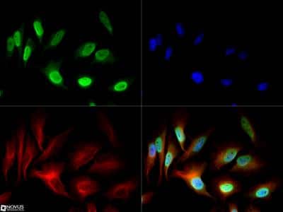 Immunocytochemistry/Immunofluorescence: NuMA Antibody [NB500-174] - NuMA antibody was tested in HeLa cells with DyLight 488 (green). Nuclei and alpha-tubulin were counterstained with DAPI (blue) and DyLight 550 (red).