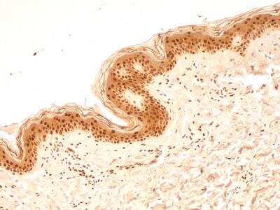 Immunohistochemistry-Paraffin: NuMA Antibody [NB500-174] - Analysis of FFPE tissue section of human normal skin using rabbit polyclonal NuMA antibody (NB500-174) at 5 ug/mL. Almost all the cells in the epidermal layer and the cells in the connective tissue of dermal layer depicted very strong nuclear along with moderate cytoplasmic immuno-positivity for NuMA protein. 10X Magnification.