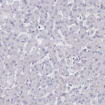 Immunohistochemistry-Paraffin: OMgp Antibody [NBP1-82483] - Staining of human liver shows no positivity in hepatocytes as expected.