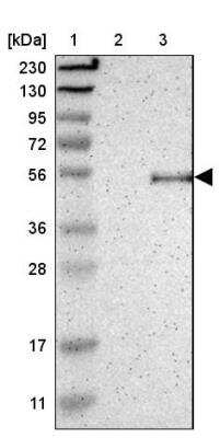 Western Blot: OMgp Antibody [NBP1-82483] - Lane 1: Marker  [kDa] 230, 130, 95, 72, 56, 36, 28, 17, 11.  Lane 2: Human cell line RT-4.  Lane 3: Human cell line U-251MG sp