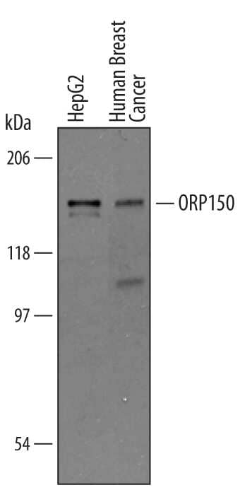 Western blot shows lysates of HepG2 human hepatocellular carcinoma cell line and human breast cancer tissue. PVDF membrane was probed with 1 µg/mL of Goat Anti-Human ORP150/HSP12A Antigen Affinity-purified Polyclonal Antibody (Catalog # AF5558) followed by HRP-conjugated Anti-Goat IgG Secondary Antibody (Catalog # HAF019). A specific band was detected for ORP150/HSP12A at approximately 150 kDa (as indicated). This experiment was conducted under reducing conditions and using Immunoblot Buffer Group 8.