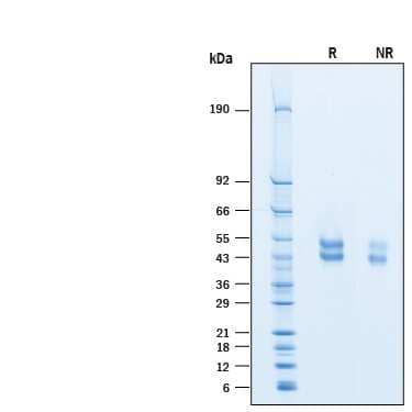 2 μg/lane of Recombinant Cynomolgus Monkey OX40/TNFRSF4His-tag (Catalog # 10137-OX) was resolved with SDS-PAGE under reducing (R) andnon-reducing (NR) conditions and visualized by Coomassie® Blue staining,showing bands at 40-55 kDa.