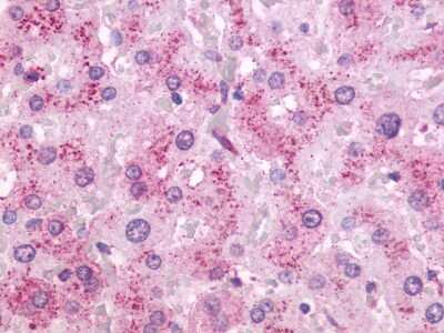 Immunohistochemistry-Paraffin: OXER1/5-oxo-ETE GPCR Antibody [NLS2272] - Analysis of anti-OXER1 antibody with human liver.