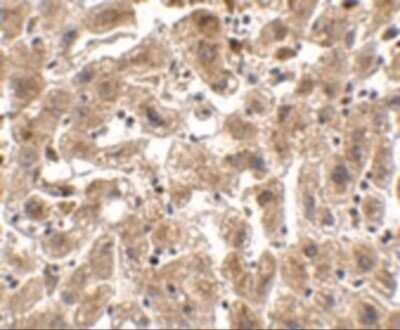 Immunohistochemistry-Paraffin: Occludin Antibody [NBP1-77037] - Immunohistochemistry of OCLN in human liver tissue with OCLN antibody at 2.5 ug/mL.