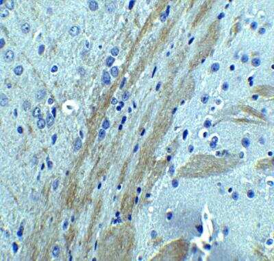 Immunohistochemistry-Paraffin: Occludin Antibody [NBP1-77037] - Mouse brain tissue with OCLN Antibody at 5 ug/mL.