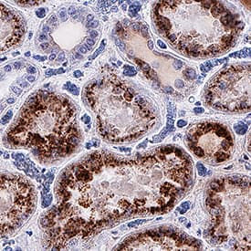   Osteopontin/OPN  was detected in immersion fixed paraffin-embedded sections of human kidney  using Rabbit Anti-Human Osteopontin/OPN Monoclonal Antibody (Catalog #  MAB14333) at 3 µg/mL for 1 hour at room temperature  followed by incubation with the Anti-Rabbit IgG VisUCyte™ HRP  Polymer Antibody (Catalog # VC003).  Before incubation with the primary antibody, tissue was subjected to  heat-induced epitope retrieval using Antigen Retrieval Reagent-Basic (Catalog  # CTS013).  Tissue was stained using DAB (brown) and counterstained with hematoxylin  (blue). Specific staining was localized to cytoplasm in epithelial cells in  convoluted tubules. View our protocol for IHC  Staining with VisUCyte HRP Polymer Detection Reagents.