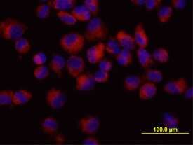 Osteoprotegerin/TNFRSF11B was detected in immersion fixed MG-63 human osteosarcoma cell line using 10 µg/mL Goat Anti-Human Osteoprotegerin/ TNFRSF11B Biotinylated Antigen Affinity-purified Polyclonal Antibody (Catalog # BAF805) for 3 hours at room temperature. Cells were stained with the NorthernLights™ 557-conjugated Streptavidin (red; Catalog # NL999) and counter-stained with DAPI (blue). View our protocol for Fluorescent ICC Staining of Cells on Coverslips.