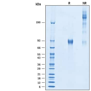 2 μg/lane of Recombinant Human Otolin-1 His-tag (Catalog 10234-OT) was  resolved with SDS-PAGE under reducing (R) and non-reducing (NR)  conditions and visualized by Coomassie® Blue staining, showing bands at 84-94 kDa and oligomers, respectively.