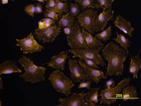 P-Cadherin was detected in immersion fixed XB2 mouse teratoma keratinocyte cell line using Anti-Human/Mouse P-Cadherin Monoclonal Antibody (Catalog # MAB761) at 10 µg/mL for 3 hours at room temperature. Cells were stained using the NorthernLights™ 557-conjugated Anti-Rat IgG Secondary Antibody (yellow; Catalog # NL013) and counterstained with DAPI (blue). View our protocol for Fluorescent ICC Staining of Cells on Coverslips.