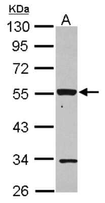 P2X2/P2RX2 Antibody (NBP2-19656): Novus Biologicals