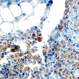   P2Y10/P2RY10  was detected in immersion fixed paraffin-embedded sections of human thymus  using Mouse Anti-Human P2Y10/P2RY10 Monoclonal Antibody (Catalog # MAB10158)  at 15 µg/mL for 1 hour at room temperature followed by  incubation with the Anti-Mouse IgG VisUCyte™ HRP Polymer Antibody  (Catalog # VC001).  Before incubation with the primary antibody, tissue was subjected to  heat-induced epitope retrieval using Antigen Retrieval Reagent-Basic (Catalog  # CTS013).  Tissue was stained using DAB (brown) and counterstained with hematoxylin  (blue). Specific staining was localized to cytoplasm. View our protocol for  IHC  Staining with VisUCyte HRP Polymer Detection Reagents.