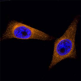 Protein Disulfide Isomerase/P4HB was detected in formaldehyde fixed HeLa human cervical epithelial carcinoma cell line using Mouse Anti-Human Protein Disulfide Isomerase/P4HB Biotinylated Monoclonal Antibody (Catalog # BAM4236) at 25 µg/mL overnight at 4 ° C. Cells were stained using the NorthernLights™ 557-conjugated Streptavidin (orange; Catalog # NL999) and counterstained with DAPI (blue). Specific staining was localized to the endoplasmic reticulum. View our protocol for Fluorescent ICC Staining of Cells on Coverslips.