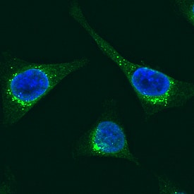 Protein Disulfide Isomerase/P4HB was detected in formaldehyde fixed HeLa human cervical epithelial carcinoma cell line using Mouse Anti-Human Protein Disulfide Isomerase/P4HB Alexa Fluor® 488‑conjugated Monoclonal Antibody (Catalog # IC4236G) at 1:10 dilution for 3 hours at room temperature and counterstained with DAPI (blue). Specific staining was localized to the endoplasmic reticulum. View our protocol for Fluorescent ICC Staining of Cells on Coverslips.