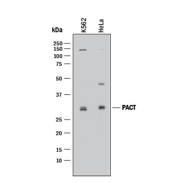 Western blot shows lysates of K562 human chronic myelogenous leukemia cell line and HeLa human cervical epithelial carcinoma cell line. PVDF membrane was probed with 1 µg/mL of Goat Anti-Human PACT Antigen Affinity-purified Polyclonal Antibody (Catalog # AF1980) followed by HRP-conjugated Anti-Goat IgG Secondary Antibody (Catalog # HAF017). A specific band was detected for PACT at approximately 32 kDa (as indicated). This experiment was conducted under reducing conditions and using Immunoblot Buffer Group 1.